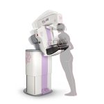 Mamografski sistemi